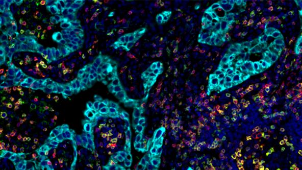 A la vanguardia del escaneo de portaobjetos: Fenotipificación de una sola célula en muestras fijas